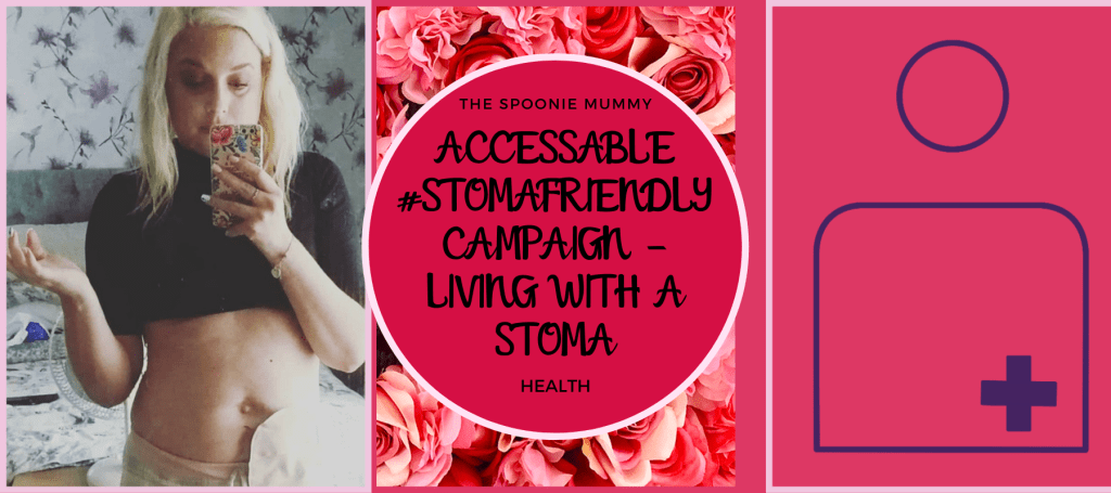 AccessAble #stomafriendly Campaign – Living With A Stoma