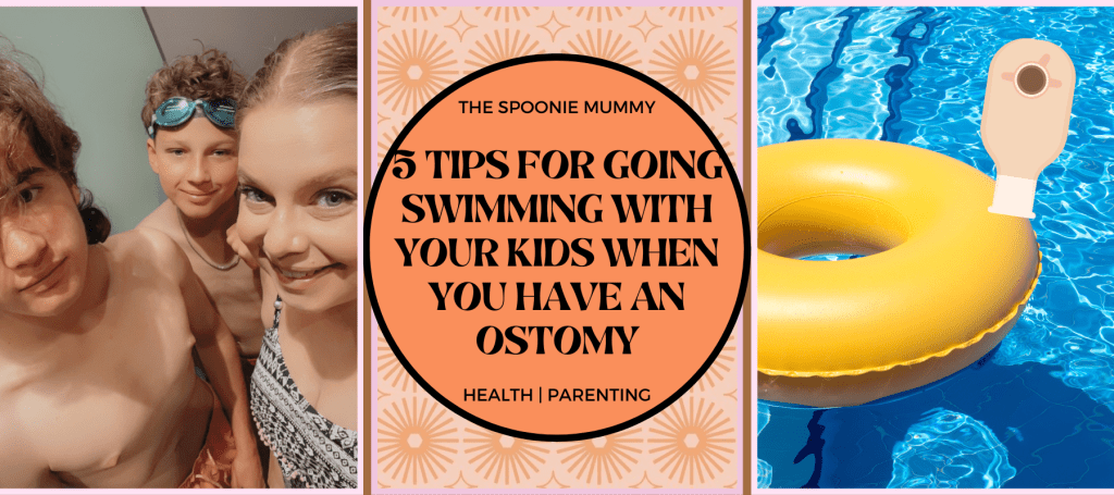 Five Tips For Going Swimming With Your Kids When You Have An Ostomy