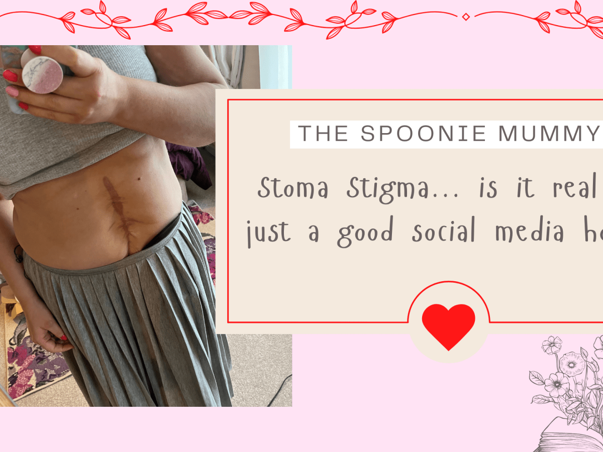 Stoma Stigma… is it real or just a good social media&nbsp;hook?